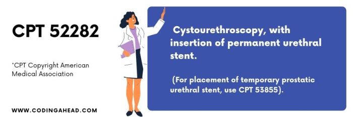 Cpt code for aspiration of cyst