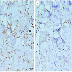 Penis tissue grow